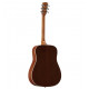 Alvarez - AD60 2