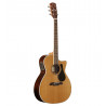 Alvarez - AG75WCE 1