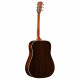 Alvarez - MD70EBG 3